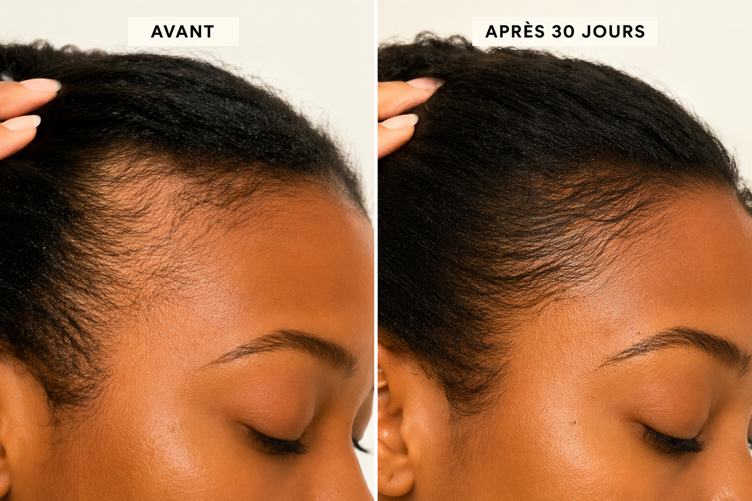 Spray Activateur de Pousse - COMME GRAND MERE