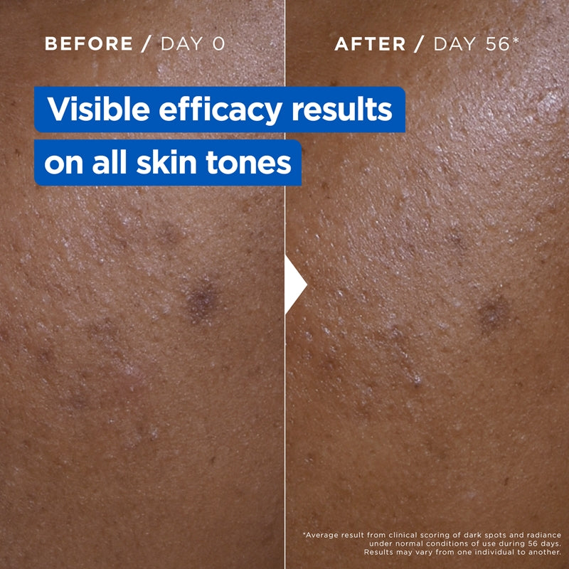 Crème NIACINAMIDE CORRECTION ECLAT 400ml - MIXA