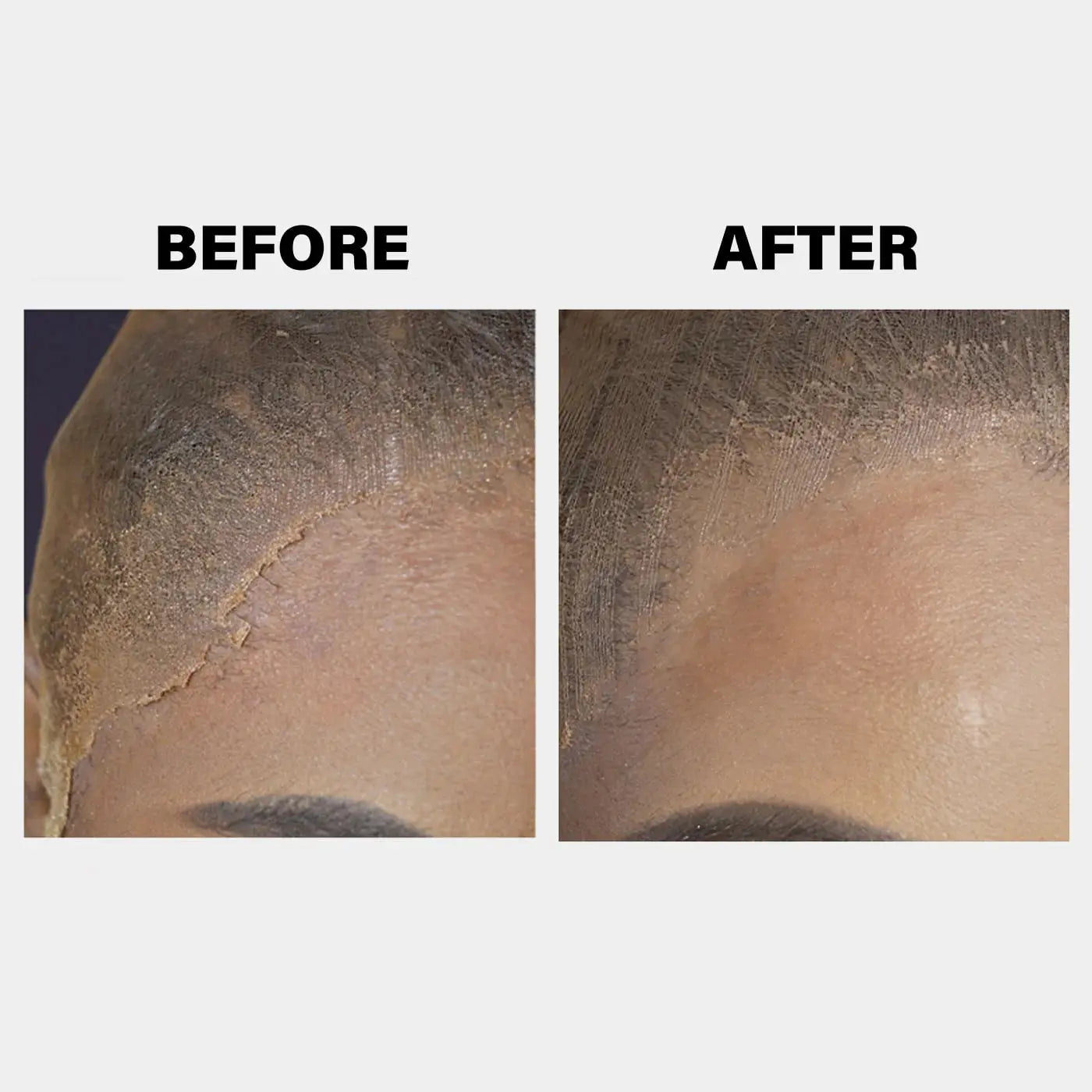 EBIN - Lace Melt Spray à la vitamine E 180mL EBIN